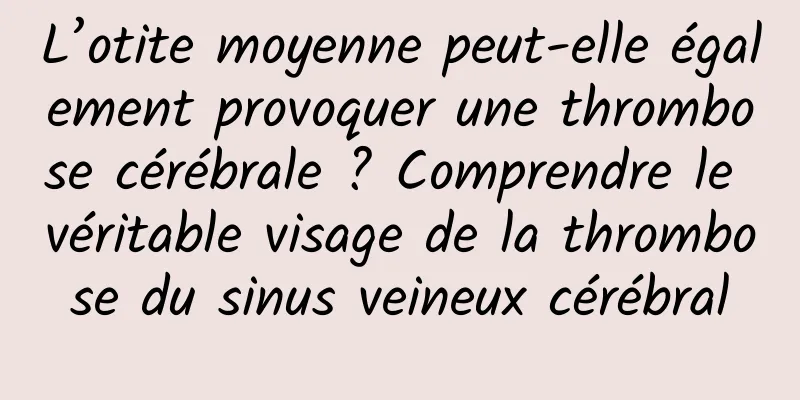 L’otite moyenne peut-elle également provoquer une thrombose cérébrale ? Comprendre le véritable visage de la thrombose du sinus veineux cérébral