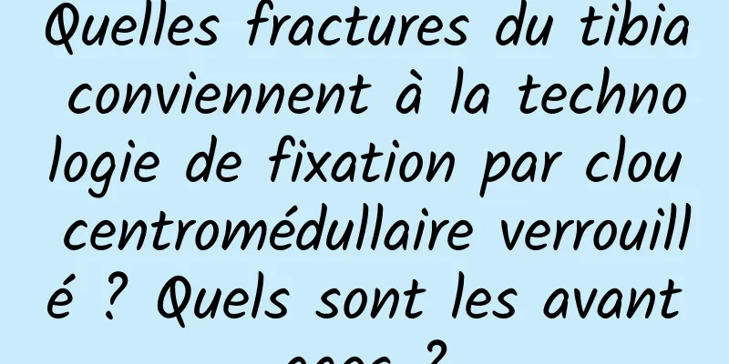 Quelles fractures du tibia conviennent à la technologie de fixation par clou centromédullaire verrouillé ? Quels sont les avantages ?