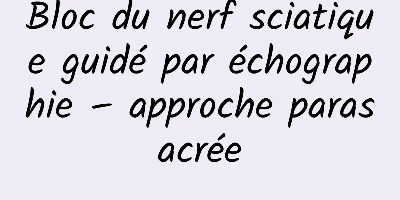 Bloc du nerf sciatique guidé par échographie – approche parasacrée
