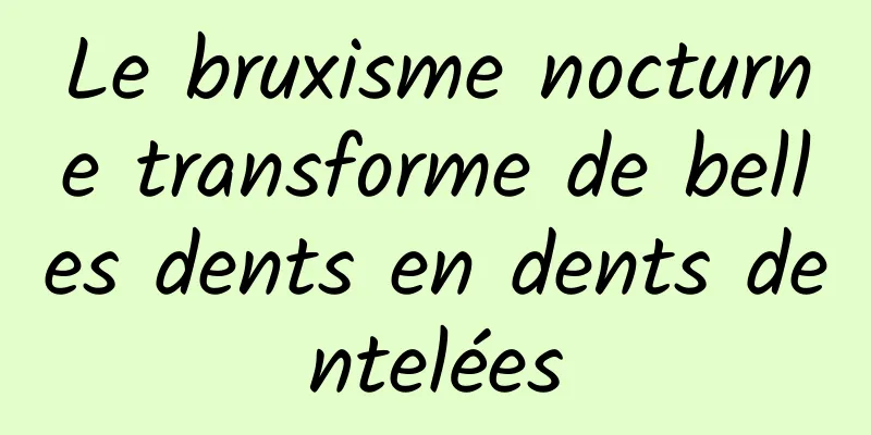Le bruxisme nocturne transforme de belles dents en dents dentelées
