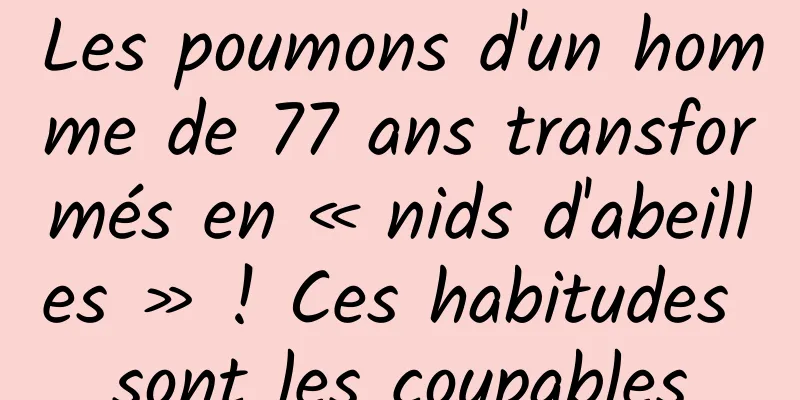 Les poumons d'un homme de 77 ans transformés en « nids d'abeilles » ! Ces habitudes sont les coupables