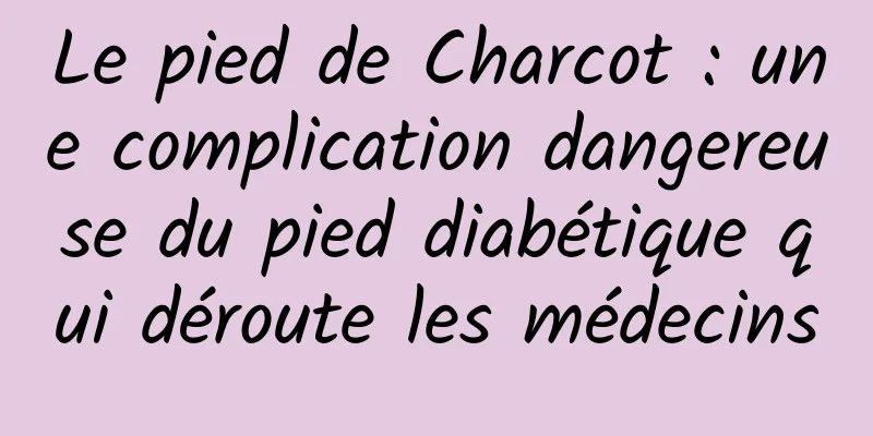 Le pied de Charcot : une complication dangereuse du pied diabétique qui déroute les médecins