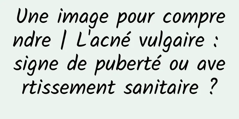 Une image pour comprendre | L'acné vulgaire : signe de puberté ou avertissement sanitaire ?