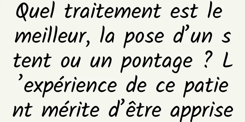 Quel traitement est le meilleur, la pose d’un stent ou un pontage ? L’expérience de ce patient mérite d’être apprise