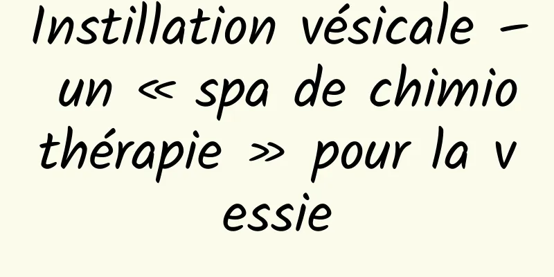 Instillation vésicale – un « spa de chimiothérapie » pour la vessie