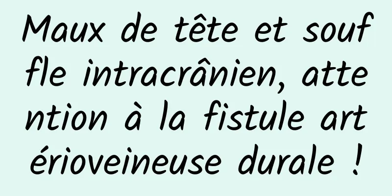 Maux de tête et souffle intracrânien, attention à la fistule artérioveineuse durale !