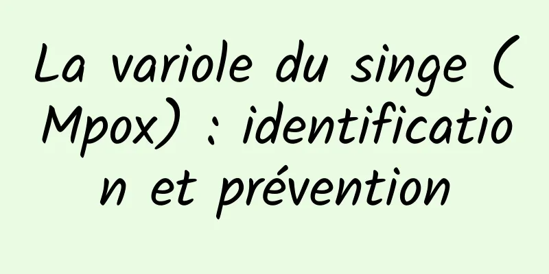 La variole du singe (Mpox) : identification et prévention