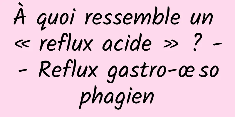 À quoi ressemble un « reflux acide » ? -- Reflux gastro-œsophagien