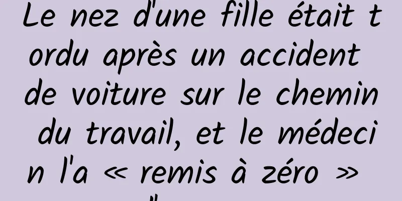 Le nez d'une fille était tordu après un accident de voiture sur le chemin du travail, et le médecin l'a « remis à zéro » d'urgence