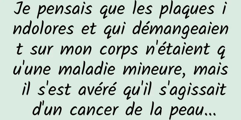 Je pensais que les plaques indolores et qui démangeaient sur mon corps n'étaient qu'une maladie mineure, mais il s'est avéré qu'il s'agissait d'un cancer de la peau...