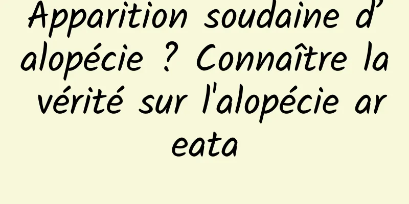 Apparition soudaine d’alopécie ? Connaître la vérité sur l'alopécie areata