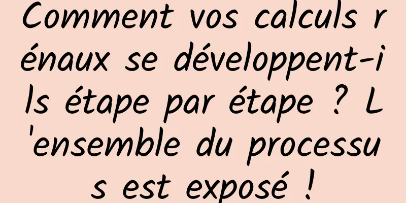 Comment vos calculs rénaux se développent-ils étape par étape ? L'ensemble du processus est exposé !