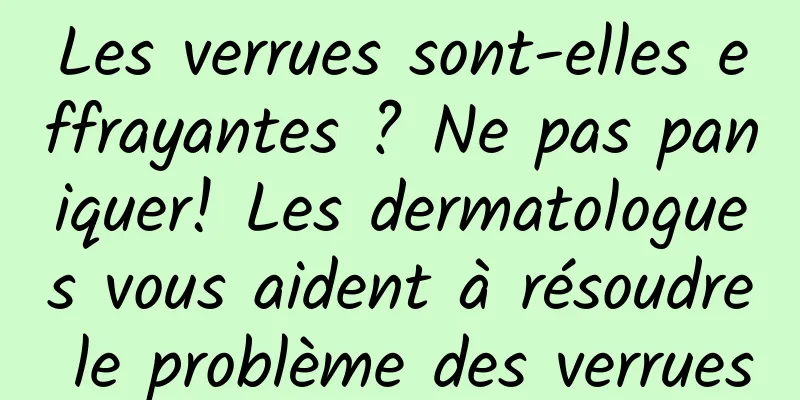 Les verrues sont-elles effrayantes ? Ne pas paniquer! Les dermatologues vous aident à résoudre le problème des verrues