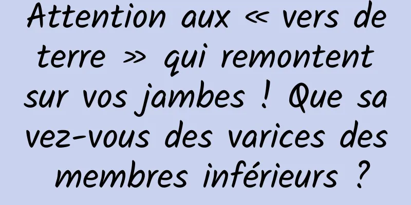 Attention aux « vers de terre » qui remontent sur vos jambes ! Que savez-vous des varices des membres inférieurs ?