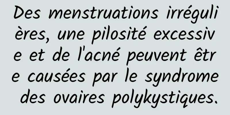 Des menstruations irrégulières, une pilosité excessive et de l'acné peuvent être causées par le syndrome des ovaires polykystiques.