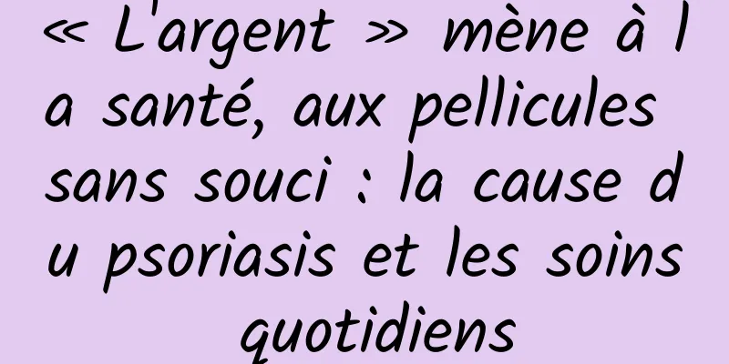 « L'argent » mène à la santé, aux pellicules sans souci : la cause du psoriasis et les soins quotidiens