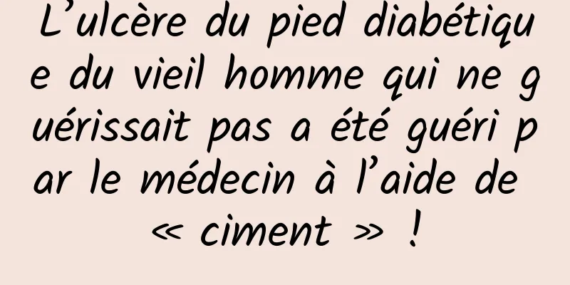 L’ulcère du pied diabétique du vieil homme qui ne guérissait pas a été guéri par le médecin à l’aide de « ciment » !