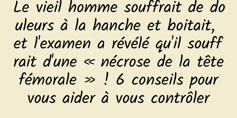 Le vieil homme souffrait de douleurs à la hanche et boitait, et l'examen a révélé qu'il souffrait d'une « nécrose de la tête fémorale » ! 6 conseils pour vous aider à vous contrôler