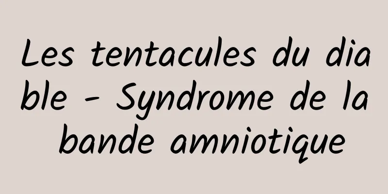 Les tentacules du diable - Syndrome de la bande amniotique