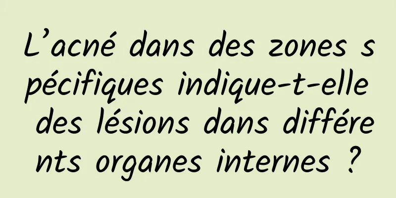L’acné dans des zones spécifiques indique-t-elle des lésions dans différents organes internes ?