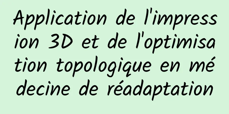 Application de l'impression 3D et de l'optimisation topologique en médecine de réadaptation