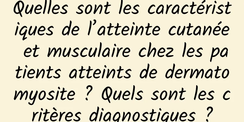 Quelles sont les caractéristiques de l’atteinte cutanée et musculaire chez les patients atteints de dermatomyosite ? Quels sont les critères diagnostiques ?