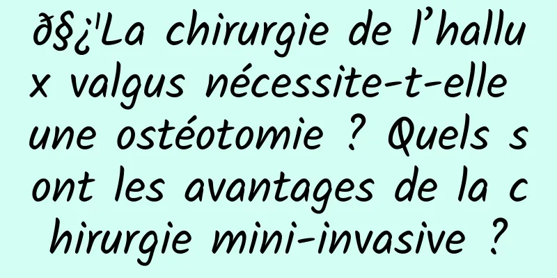 𧿹La chirurgie de l’hallux valgus nécessite-t-elle une ostéotomie ? Quels sont les avantages de la chirurgie mini-invasive ?