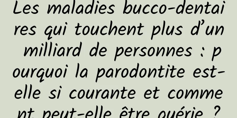 Les maladies bucco-dentaires qui touchent plus d’un milliard de personnes : pourquoi la parodontite est-elle si courante et comment peut-elle être guérie ?