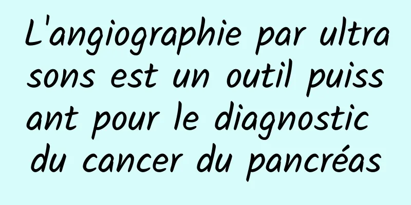 L'angiographie par ultrasons est un outil puissant pour le diagnostic du cancer du pancréas