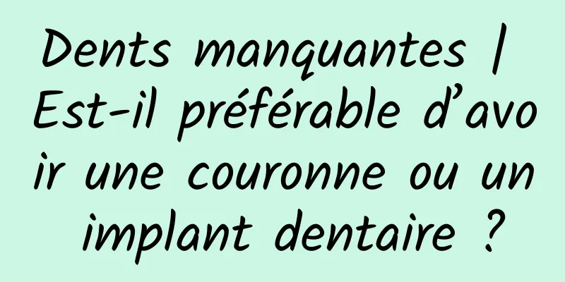 Dents manquantes | Est-il préférable d’avoir une couronne ou un implant dentaire ?