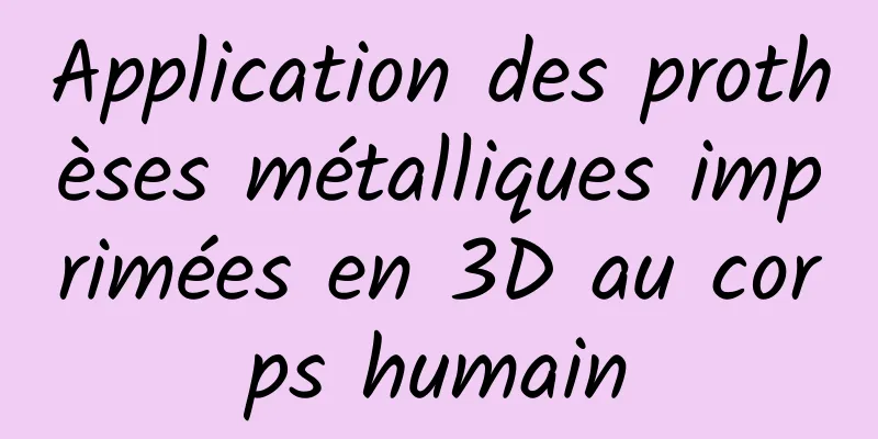 Application des prothèses métalliques imprimées en 3D au corps humain