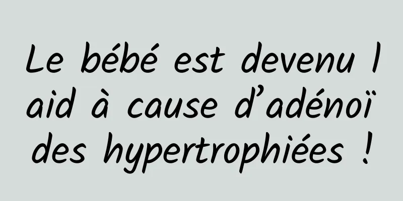 Le bébé est devenu laid à cause d’adénoïdes hypertrophiées !