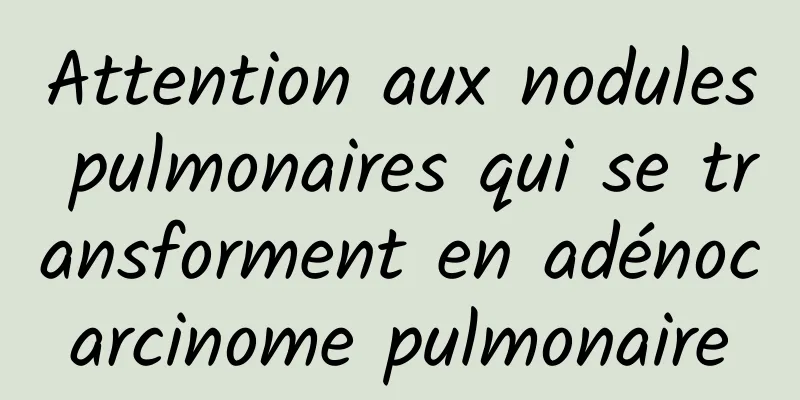 Attention aux nodules pulmonaires qui se transforment en adénocarcinome pulmonaire