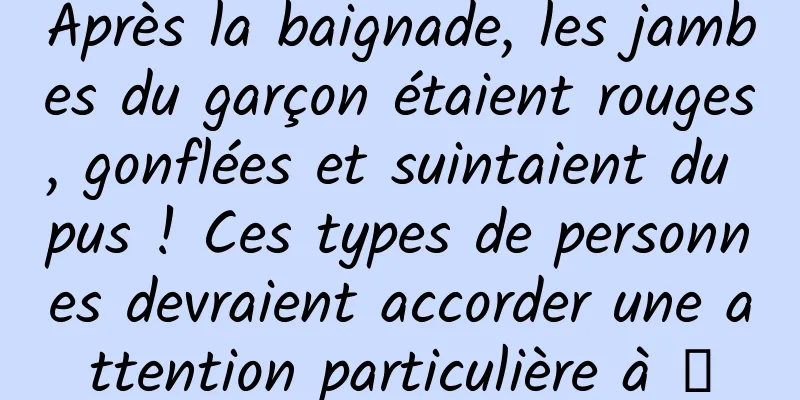 Après la baignade, les jambes du garçon étaient rouges, gonflées et suintaient du pus ! Ces types de personnes devraient accorder une attention particulière à →