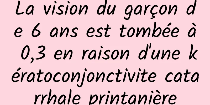 La vision du garçon de 6 ans est tombée à 0,3 en raison d'une kératoconjonctivite catarrhale printanière