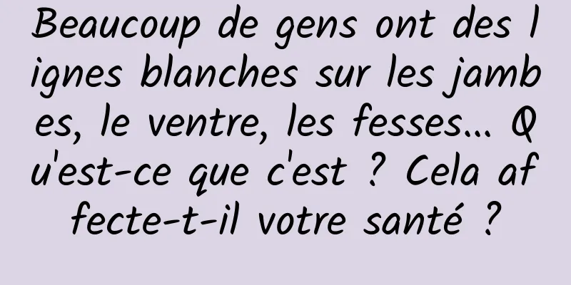 Beaucoup de gens ont des lignes blanches sur les jambes, le ventre, les fesses... Qu'est-ce que c'est ? Cela affecte-t-il votre santé ?