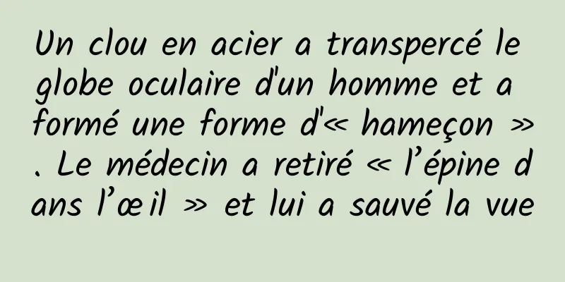 Un clou en acier a transpercé le globe oculaire d'un homme et a formé une forme d'« hameçon ». Le médecin a retiré « l’épine dans l’œil » et lui a sauvé la vue