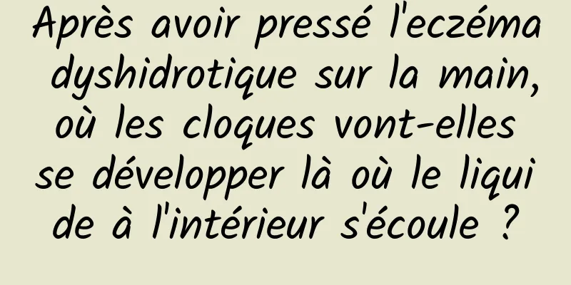 Après avoir pressé l'eczéma dyshidrotique sur la main, où les cloques vont-elles se développer là où le liquide à l'intérieur s'écoule ?