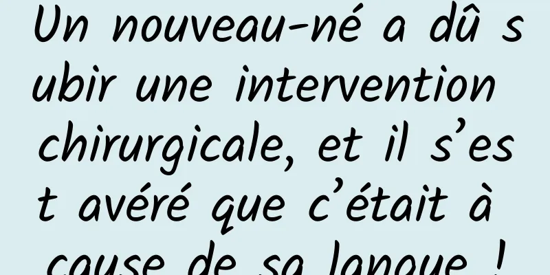 Un nouveau-né a dû subir une intervention chirurgicale, et il s’est avéré que c’était à cause de sa langue !