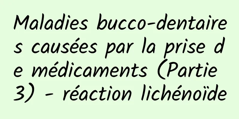 Maladies bucco-dentaires causées par la prise de médicaments (Partie 3) - réaction lichénoïde