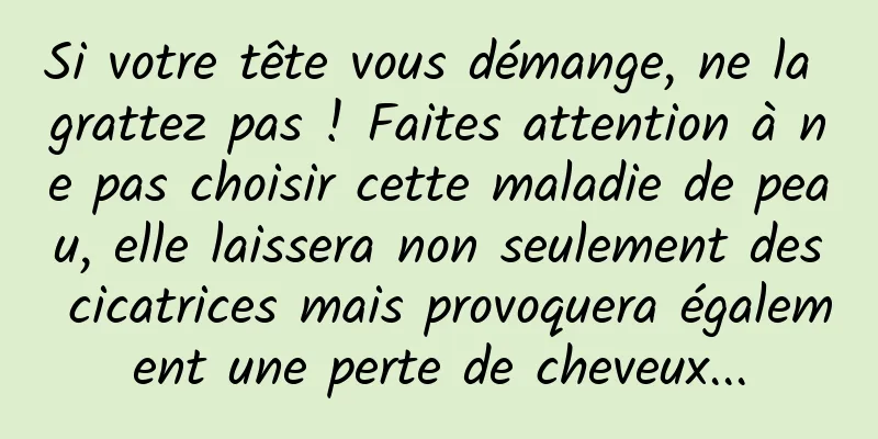 Si votre tête vous démange, ne la grattez pas ! Faites attention à ne pas choisir cette maladie de peau, elle laissera non seulement des cicatrices mais provoquera également une perte de cheveux...