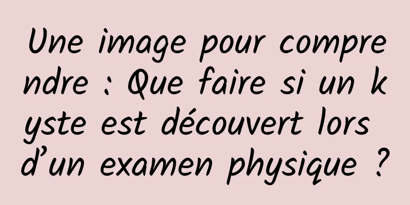 Une image pour comprendre : Que faire si un kyste est découvert lors d’un examen physique ?