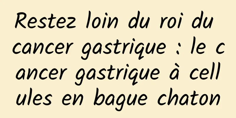 Restez loin du roi du cancer gastrique : le cancer gastrique à cellules en bague chaton