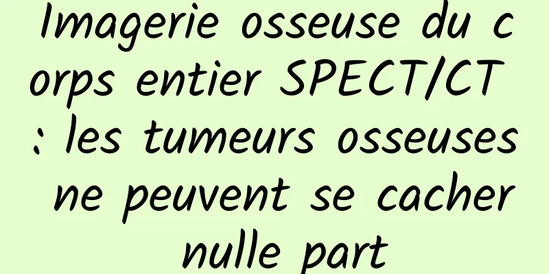 Imagerie osseuse du corps entier SPECT/CT : les tumeurs osseuses ne peuvent se cacher nulle part