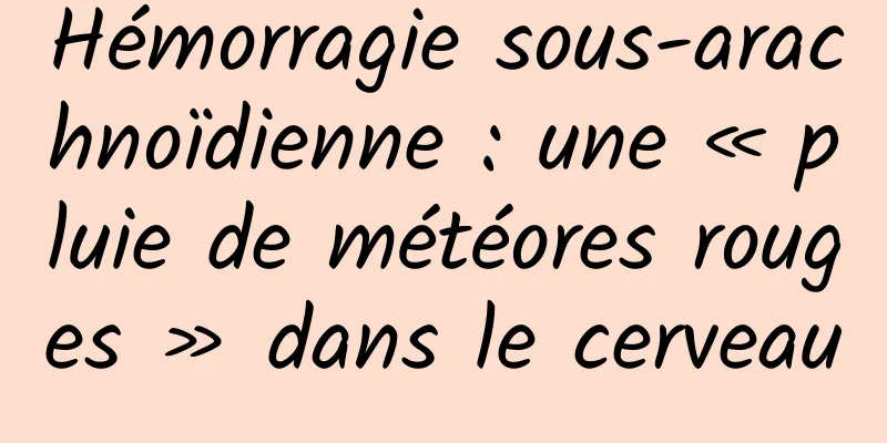 Hémorragie sous-arachnoïdienne : une « pluie de météores rouges » dans le cerveau