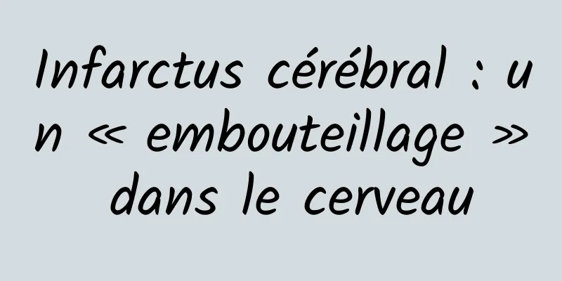 Infarctus cérébral : un « embouteillage » dans le cerveau