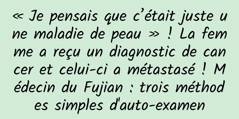 « Je pensais que c’était juste une maladie de peau » ! La femme a reçu un diagnostic de cancer et celui-ci a métastasé ! Médecin du Fujian : trois méthodes simples d'auto-examen