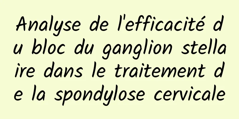 Analyse de l'efficacité du bloc du ganglion stellaire dans le traitement de la spondylose cervicale
