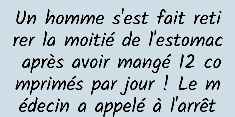Un homme s'est fait retirer la moitié de l'estomac après avoir mangé 12 comprimés par jour ! Le médecin a appelé à l'arrêt