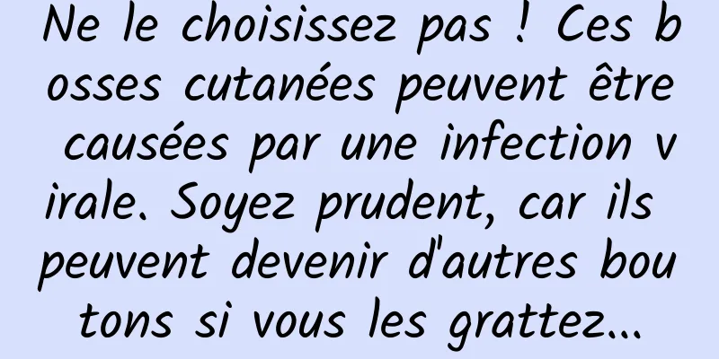 Ne le choisissez pas ! Ces bosses cutanées peuvent être causées par une infection virale. Soyez prudent, car ils peuvent devenir d'autres boutons si vous les grattez...